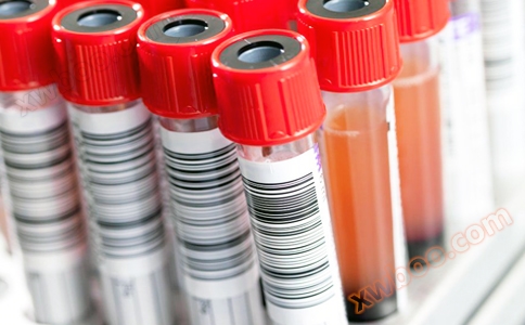 RFID高频读写器应用于试管试剂管理